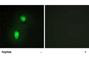 Immunofluorescence analysis of HUVEC cells, using HNRNPC polyclonal antibody . (HNRNPC Antikörper)