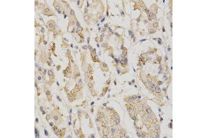 Immunohistochemistry of paraffin-embedded human stomach using STK11 antibody at dilution of 1:200 (x400 lens) (LKB1 Antikörper  (AA 134-433))