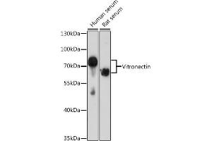 Western blot analysis of extracts of various cell lines, using Vitronectin antibody (ABIN3022357, ABIN3022358, ABIN3022359 and ABIN6218758) at 1:1000 dilution. (Vitronectin Antikörper  (AA 364-478))