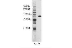 Image no. 1 for anti-Zinc Finger Protein 36, C3H Type-Like 2 (ZFP36L2) (N-Term) antibody (ABIN202655) (ZFP36L2 Antikörper  (N-Term))