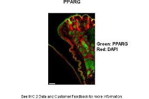 Mouse cornea and eyelid Primary Antibody Dilution: 1:100Secondary Antibody: Goat anti-rabbit-AlexaFluor-546 Secondary Antibody Dilution: 1:0000Color/Signal Descriptions: PPARG: Green DAPI: Red  Gene Name: Ppar Gamma  Submitted by: Anonymous (PPARG Antikörper  (N-Term))
