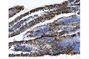 IHC analysis of VAPA using anti-VAPA antibody (ABIN7603249). (VAPA Antikörper  (N-Term))