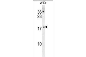 CHCHD2 Antibody (Center) (ABIN654013 and ABIN2843939) western blot analysis in WiDr cell line lysates (35 μg/lane). (CHCHD2 Antikörper  (AA 74-103))