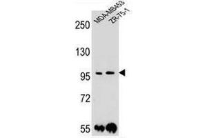 PCDH1 Antibody (N-term) western blot analysis in MDA-MB453,ZR-75-1 cell line lysates (35µg/lane). (Protocadherin 1 Antikörper  (N-Term))