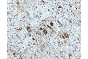 Rat cerebellum, formalin-fixed paraffin embedded tissue, with citrate pre-treatment, 20X. (Gephyrin Antikörper  (AA 569-726))
