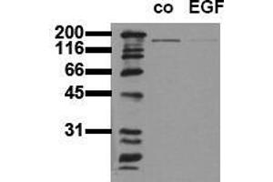 Western Blotting (WB) image for anti-Epidermal Growth Factor Receptor (EGFR) (Tyr1197) antibody (ABIN126780) (EGFR Antikörper  (Tyr1197))