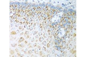 Immunohistochemistry of paraffin-embedded Human esophagus using FDXR Polyclonal Antibody at dilution of 1:100 (40x lens). (Ferredoxin Reductase Antikörper)