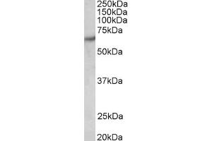 Western Blotting (WB) image for anti-P21-Activated Kinase 1 (PAK1) antibody (ABIN5904050) (PAK1 Antikörper)