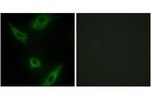 Immunofluorescence analysis of HeLa cells, using MAP3K1 Antibody. (MAP3K1 Antikörper  (AA 181-230))