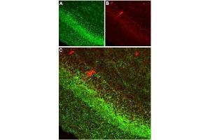 Expression of CB1 receptor in rat hippocampusImmunohistochemical staining of rat hippocampus using Anti-Cannabinoid Receptor 1 (extracellular) Antibody (ABIN7043023, ABIN7044155 and ABIN7044156) (1:100). (Cannabinoid Receptor 1 (CNR1) Peptid)