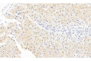 ABIN5872058 (5 µg/ml) staining of paraffin embedded Human Liver. (MGLL Antikörper)