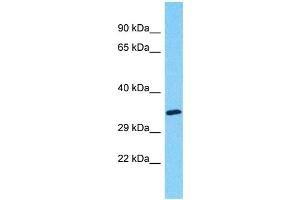 Western Blotting (WB) image for anti-Myeloid-Associated Differentiation Marker-Like 2 (MYADML2) (C-Term) antibody (ABIN2791681) (MYADML2 Antikörper  (C-Term))