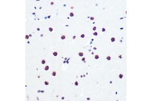 Immunohistochemistry of paraffin-embedded rat brain using P Rabbit mAb (ABIN7269445) at dilution of 1:100 (40x lens). (PABPN1 Antikörper)