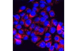 IF on PC12 cells at a concentration of 30 µg/ml using Rabbit antibody to 4th cytoplasmic loop of human TRPM7 (LTRPC7): IgG (ABIN351218), DAPI counterstained appearing in blue. (TRPM7 Antikörper  (4th Cytoplasmic Loop))