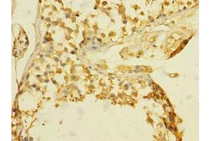 Immunohistochemistry of paraffin-embedded human testis tissue using ABIN7172811 at dilution of 1:100 (TGFBR3 Antikörper  (AA 140-340))