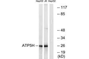 Western blot analysis of extracts from HepG2/Jurkat cells, using ATP5H Antibody.