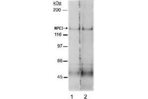 Western blot analysis of Npc1l1 in rat small intestine membrane preparations (Lane 1 : 2 ug/mL , Lane 2 : 4 ug/mL) with Npc1l1 polyclonal antibody . (NPC1L1 Antikörper  (AA 500-600))