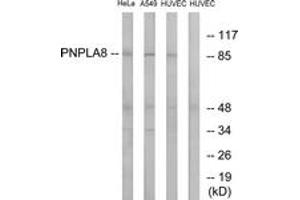 Western blot analysis of extracts from HuvEc/HeLa/A549 cells, using PNPLA8 Antibody. (PNPLA8 Antikörper  (AA 691-740))
