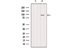 Western blot analysis of extracts from VERO, using MGH1/2 Antibody. (MGH1/2 Antikörper)