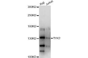 Western blot analysis of extracts of various cell lines, using TYK2 antibody (ABIN5971155) at 1/1000 dilution. (TYK2 Antikörper)