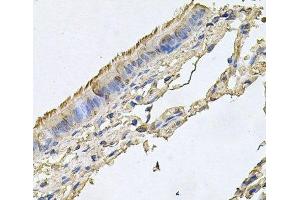 Immunohistochemistry of paraffin-embedded Human trachea using FABP12 Polyclonal Antibody at dilution of 1:100 (40x lens).