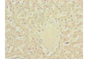 Immunohistochemistry of paraffin-embedded human liver tissue using ABIN7149326 at dilution of 1:100 (DYNC2LI1 Antikörper  (AA 1-352))