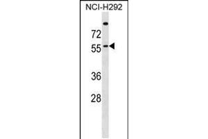 Western blot analysis in NCI-H292 cell line lysates (35ug/lane). (ZDHHC13 Antikörper  (N-Term))