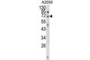 Western Blotting (WB) image for anti-Ewing Sarcoma Breakpoint Region 1 (EWSR1) antibody (ABIN3003929)