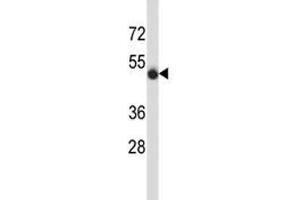 CD43 antibody western blot analysis in MDA-MB435 lysate. (CD43 Antikörper  (AA 32-60))