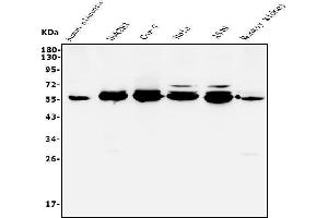 Western blot analysis of STK3/MST-2 using anti-STK3/MST-2 antibody (ABIN7601288).