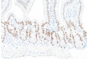 Immunohistochemistry (IHC) image for anti-Kruppel-Like Factor 5 (Intestinal) (KLF5) (AA 325-375) antibody (ABIN7795630)
