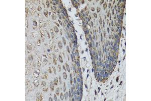 Immunohistochemistry of paraffin-embedded human esophagus using IL36G antibody at dilution of 1:100 (40x lens).