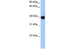 WB Suggested Anti-SSBP4 Antibody Titration:  0. (SSBP4 Antikörper  (N-Term))