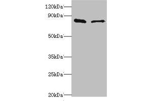 Western blot All lanes: SLC39A6 antibody at 10 μg/mL Lane 1: Hela whole cell lysate Lane 2: 293T whole cell lysate Secondary Goat polyclonal to rabbit IgG at 1/10000 dilution Predicted band size: 86, 49 kDa Observed band size: 86 kDa (SLC39A6 Antikörper  (AA 170-320))