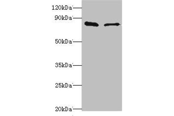SLC39A6 anticorps  (AA 170-320)