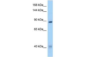 WB Suggested Anti-MUSK Antibody Titration: 1. (MUSK Antikörper  (N-Term))