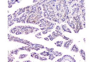 IHC analysis of EVA1A using anti-EVA1A antibody (ABIN6719564). (TMEM166 Antikörper)