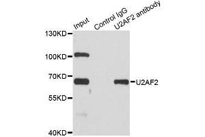 Immunoprecipitation analysis of 200ug extracts of SW620 cells using 1ug U2AF2 antibody. (U2AF2 Antikörper)