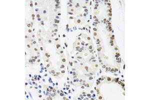 Immunohistochemistry of paraffin-embedded human stomach using SFPQ antibody (ABIN5970351) at dilution of 1/100 (40x lens). (SFPQ Antikörper)