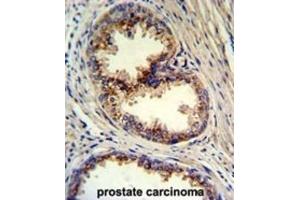 Immunohistochemistry (IHC) image for anti-Golgi phosphoprotein 3 (Coat-Protein) (GOLPH3) antibody (ABIN3003211) (GOLPH3 Antikörper)