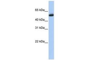 Image no. 1 for anti-Cytochrome P450, Family 4, Subfamily B, Polypeptide 1 (CYP4B1) (AA 72-121) antibody (ABIN6740739) (CYP4B1 Antikörper  (AA 72-121))