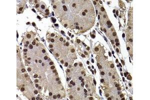 Immunohistochemistry (Paraffin-embedded Sections) (IHC (p)) image for anti-G Protein Pathway Suppressor 1 (GPS1) antibody (ABIN7262819)