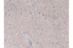 IHC-P analysis of Human Brain Tissue, with DAB staining. (IL-8 Antikörper  (AA 23-101))