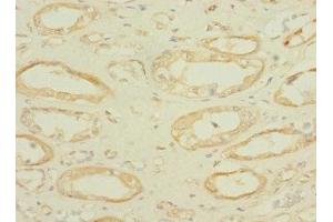 Immunohistochemistry (IHC) image for anti-Solute Carrier Family 36 (Proton/amino Acid Symporter), Member 2 (SLC36A2) (AA 1-58) antibody (ABIN7166580)