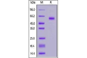 SDS-PAGE (SDS) image for Triggering Receptor Expressed On Myeloid Cells 2 (TREM2) (AA 19-174) (Active) protein (Fc Tag) (ABIN7013683)