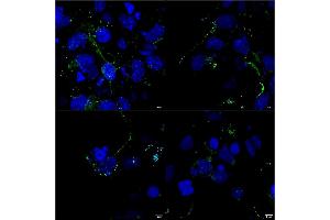 Immunocytochemistry/Immunofluorescence analysis using Mouse Anti-LRP4 Monoclonal Antibody, Clone S207-27 (ABIN2483384).