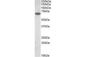 AP32138PU-N PDIA2 antibody staining of Human Pancreas lysate (35µg protein in RIPA buffer). (PDIA2 Antikörper  (Internal Region))