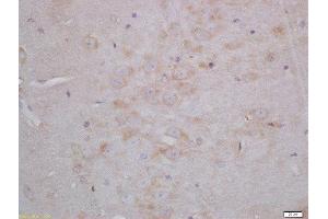 Formalin-fixed and paraffin embedded rat brain tissue labeled with Anti-Neurogranin Polyclonal Antibody, Unconjugated(ABIN1387517) 1:200, followed by conjugation to the secondary antibody and DAB.