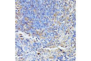 Immunohistochemistry of paraffin-embedded mouse spleen using STK24 antibody (ABIN6132364, ABIN6148602, ABIN6148603 and ABIN6214875) at dilution of 1:100 (40x lens).