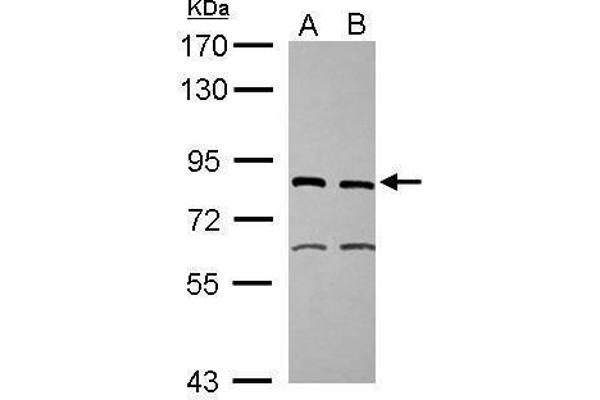 ERCC2 Antikörper  (Internal Region)